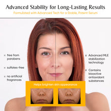 Load image into Gallery viewer, LYS Retinol Serum | LYS Advanced FACE CARE  | Easy Beauty From Korea - Bếp Ông Bụi